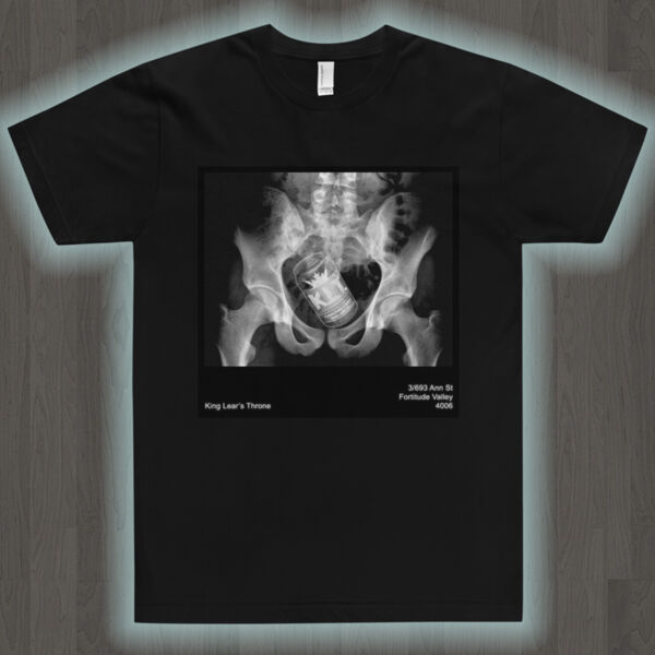 X-Ray Banned Thumbnail